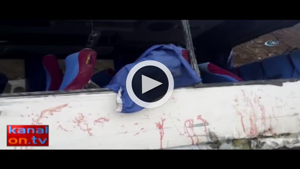 Sis faciaya neden oldu