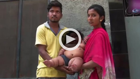 8 aylık bebek 17 kilo ağırlığında